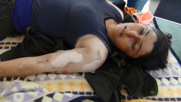 A Kurd allegedly hit with chemical weapons by the Islamic State in Kobani